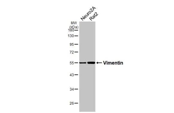 Vimentin Antibody