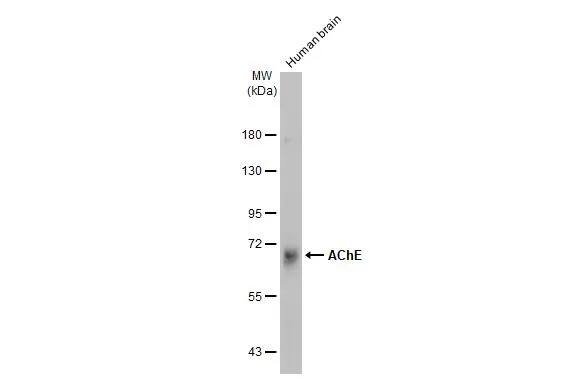 Acetylcholinesterase/ACHE Antibody