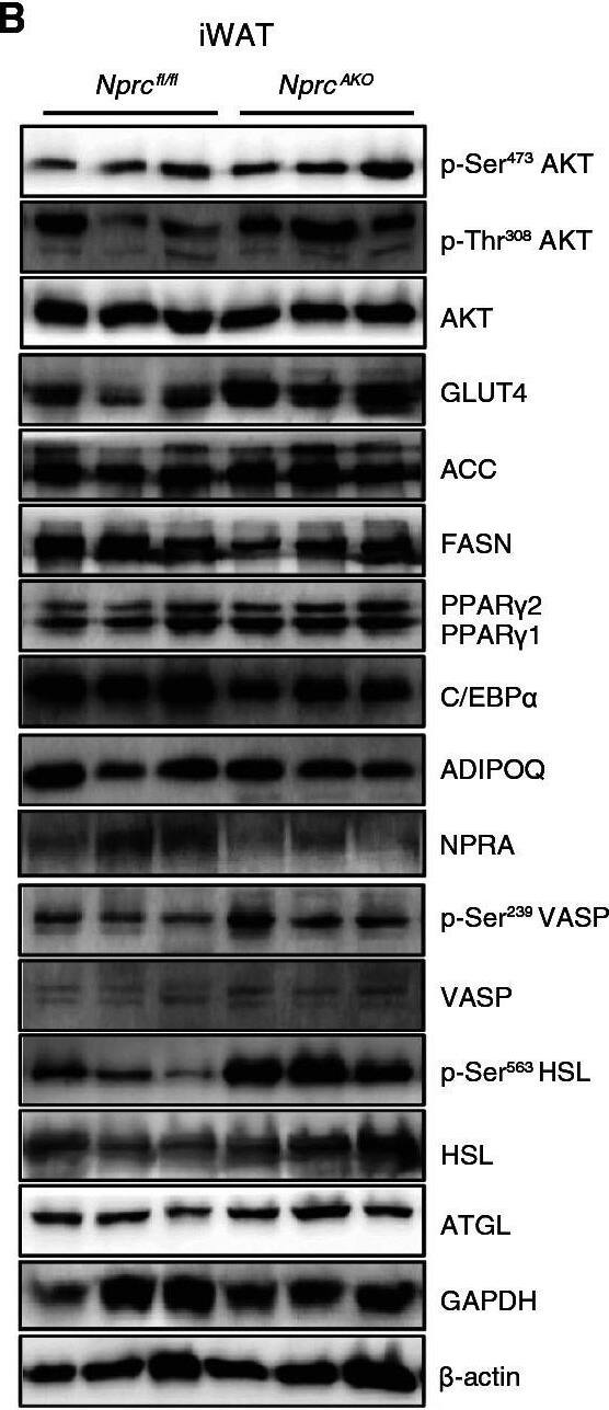 NPRA/NPR1 Antibody - BSA Free