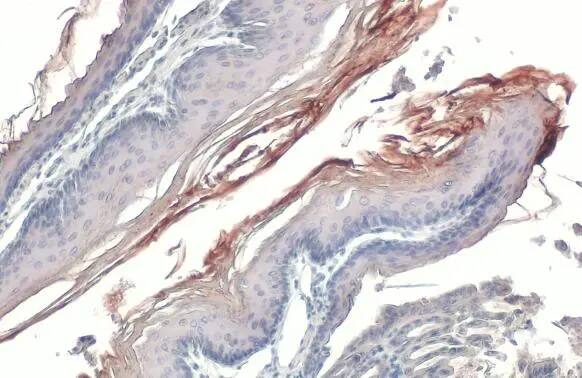 Fibronectin Antibody