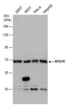 RPA70 Antibody