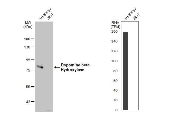 Dopamine beta-Hydroxylase Antibody
