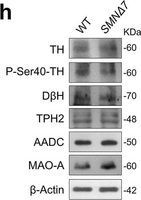 Dopamine beta-Hydroxylase Antibody
