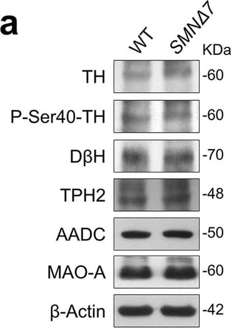 Dopamine beta-Hydroxylase Antibody