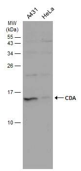 Citidine Deaminase Antibody
