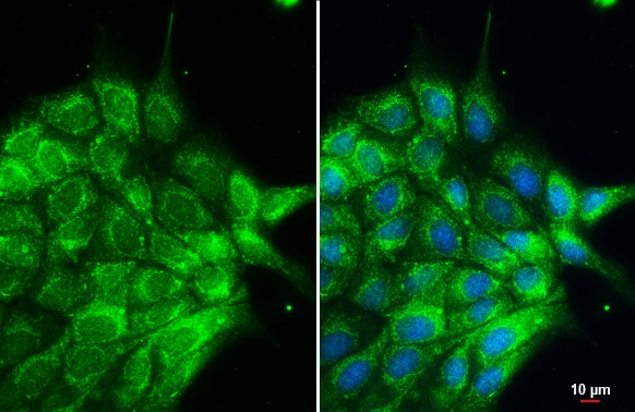 Cytokeratin 2 Antibody
