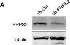PRPS2 Antibody