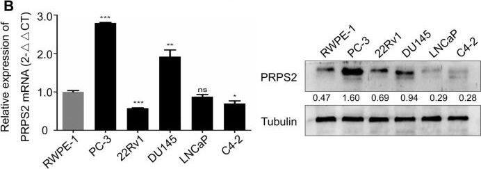 PRPS2 Antibody