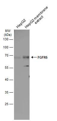 FGFR5/FGFRL1 Antibody - BSA Free