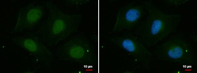 PSKH2 Antibody