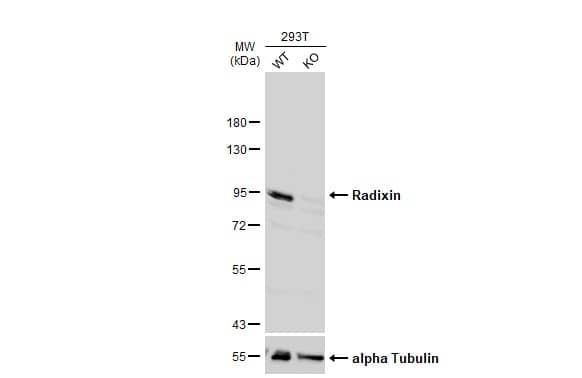 Radixin Antibody - BSA Free