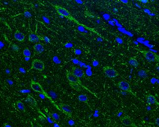alpha-N-acetylglucosaminidase/NAGLU Antibody - BSA Free
