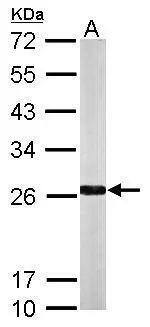NQO-2 Antibody - BSA Free