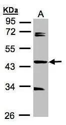 SDCCAG3 Antibody - BSA Free