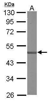 SDCCAG3 Antibody - BSA Free