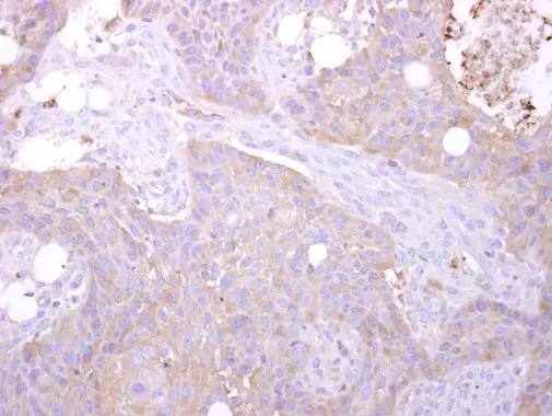 MST3 Antibody - BSA Free