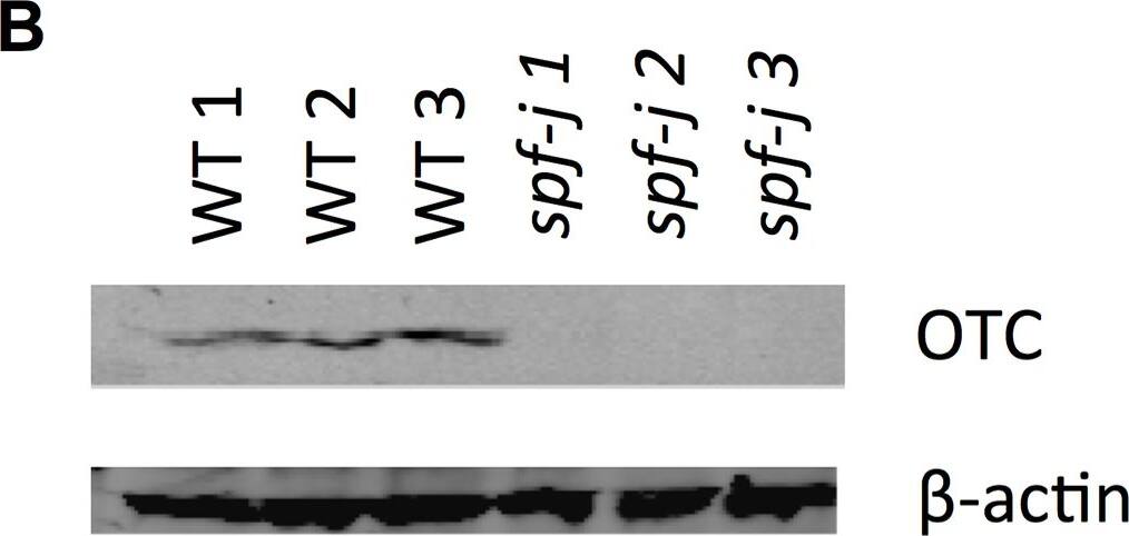 Ornithine Carbamoyltransferase Antibody
