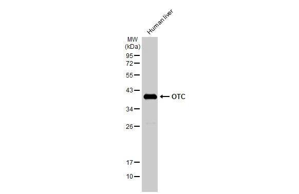 Ornithine Carbamoyltransferase Antibody - BSA Free
