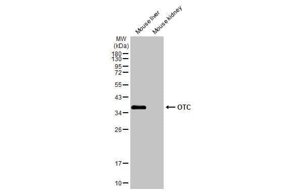 Ornithine Carbamoyltransferase Antibody - BSA Free