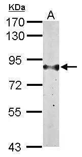 Glucose 1-dehydrogenase Antibody - BSA Free
