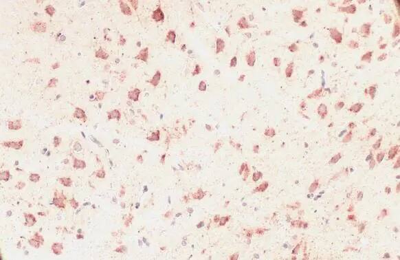 GRP75/HSPA9B/Mortalin Antibody