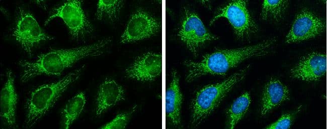 GRP75/HSPA9B/Mortalin Antibody