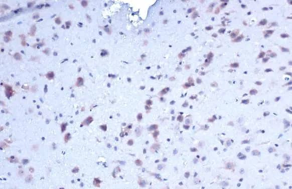 Proapoptotic Caspase Adaptor Protein Antibody
