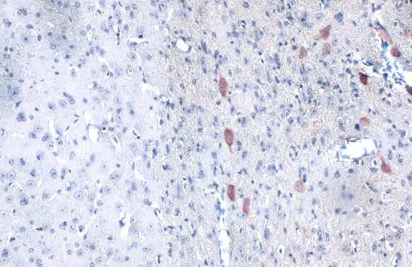 Proapoptotic Caspase Adaptor Protein Antibody