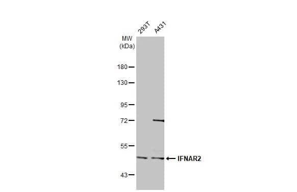 IFN-alpha/beta R2 Antibody