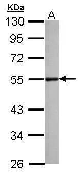 DLST Antibody