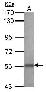 ALDH2 Antibody