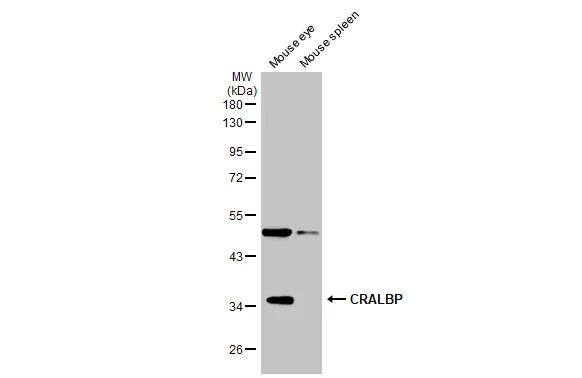 CRALBP Antibody - BSA Free