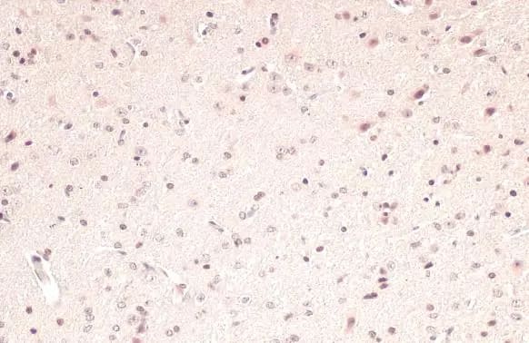PPAR alpha/NR1C1 Antibody