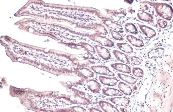 PPAR alpha/NR1C1 Antibody