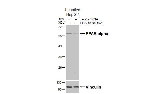 PPAR alpha/NR1C1 Antibody - BSA Free