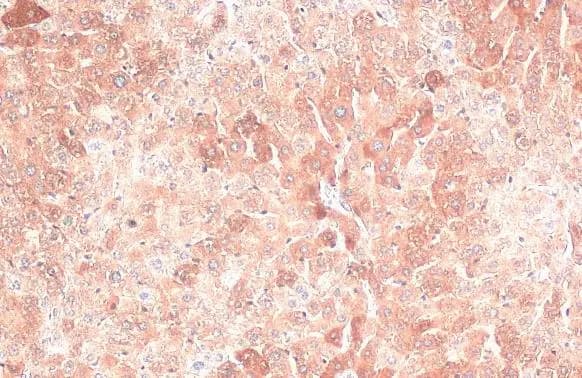 Ferritin Heavy Chain Antibody