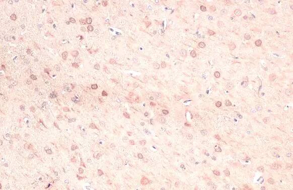 Ferritin Heavy Chain Antibody