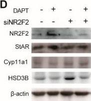 COUP-TF II/NR2F2 Antibody - BSA Free