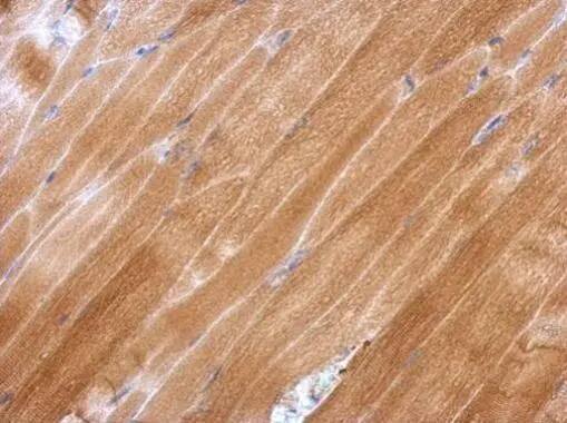 Glutathione Peroxidase 2/GPX2 Antibody