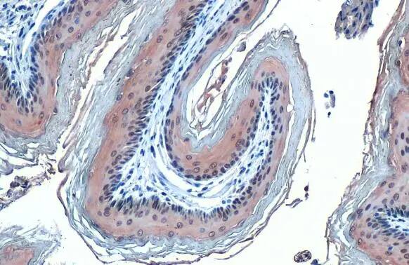 Glutathione Peroxidase 2/GPX2 Antibody