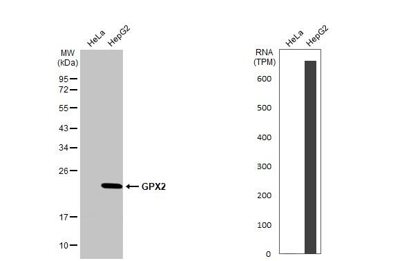 Glutathione Peroxidase 2/GPX2 Antibody - BSA Free