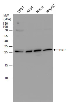BNP Antibody