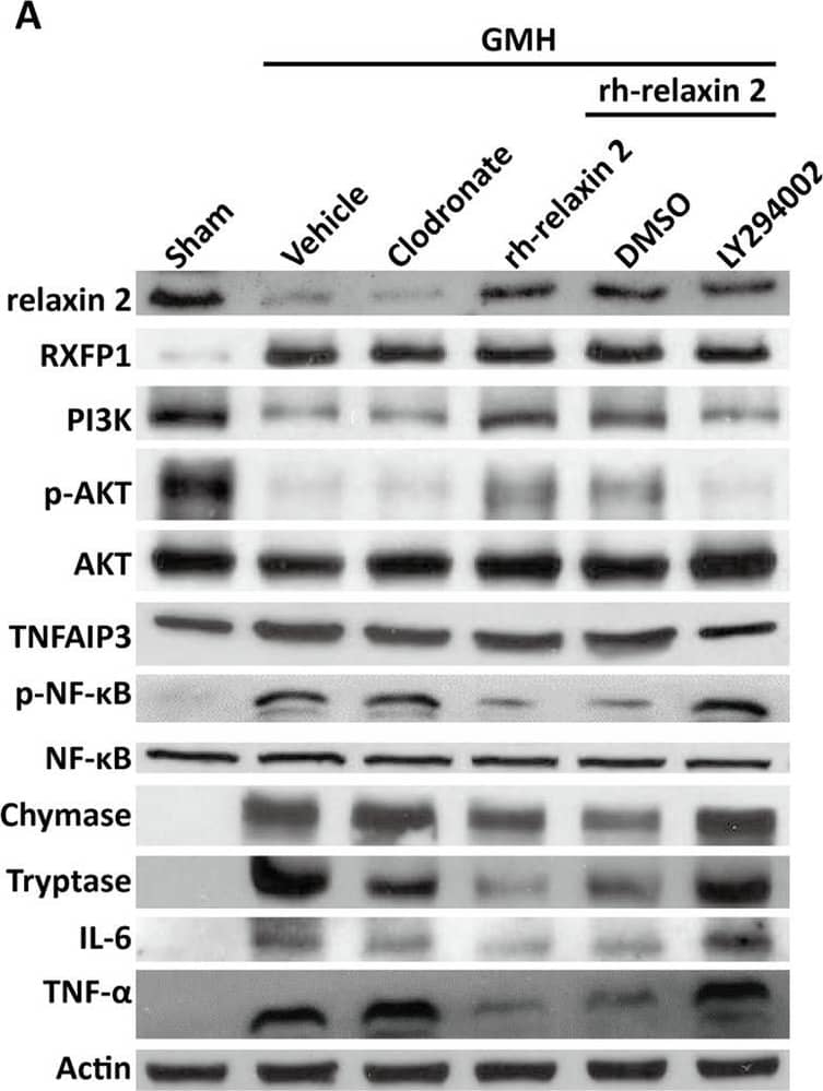NFkB2/NFkB p100 Antibody - BSA Free