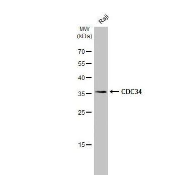 UBE2R1/CDC34 Antibody UBE2R1/CDC34 Antibody