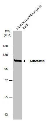 ENPP-2/Autotaxin Antibody