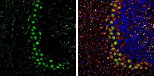 Protein Phosphatase 1 beta Antibody - BSA Free