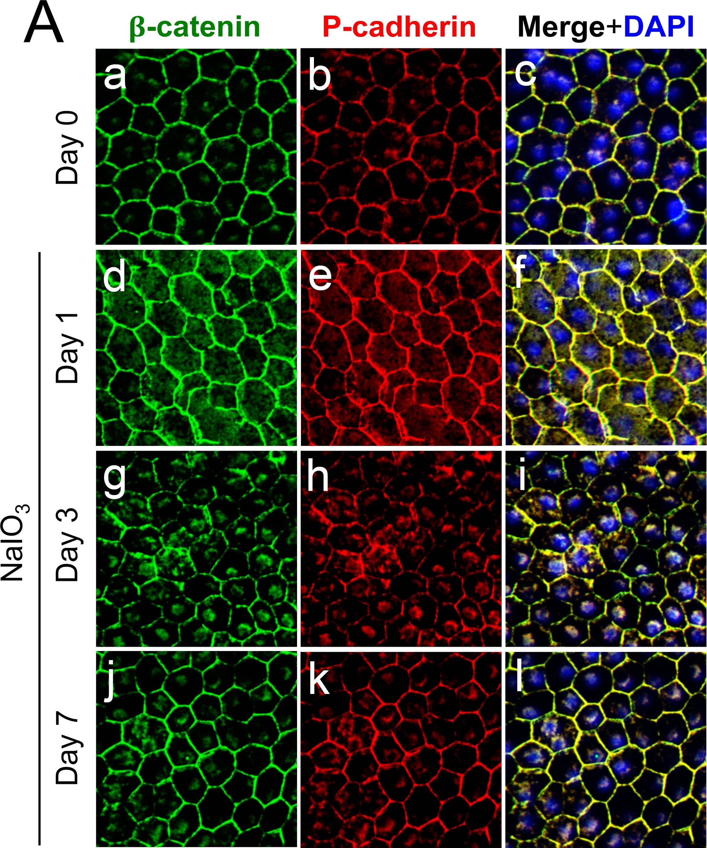 beta-Catenin Antibody