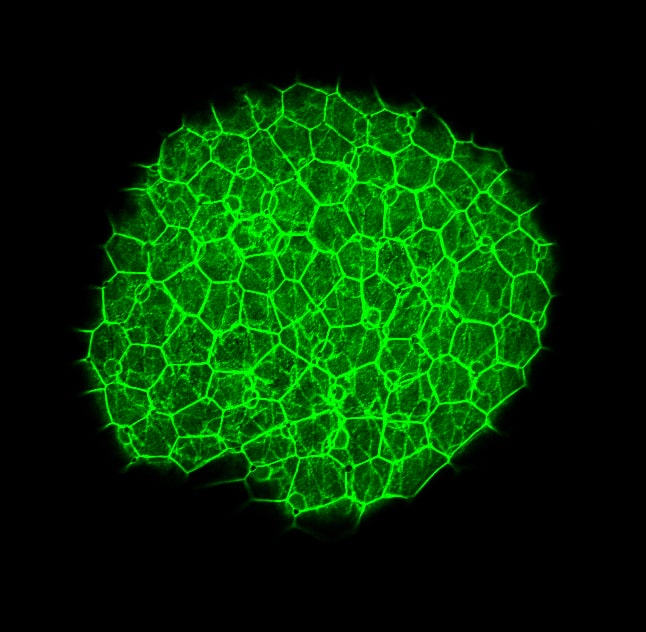 beta-Catenin Antibody