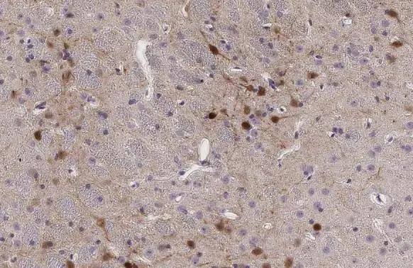 Calretinin Antibody - BSA Free