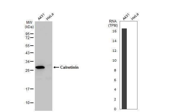 Calretinin Antibody - BSA Free